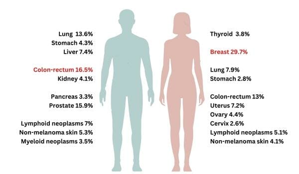 cancer stats infographic 060123